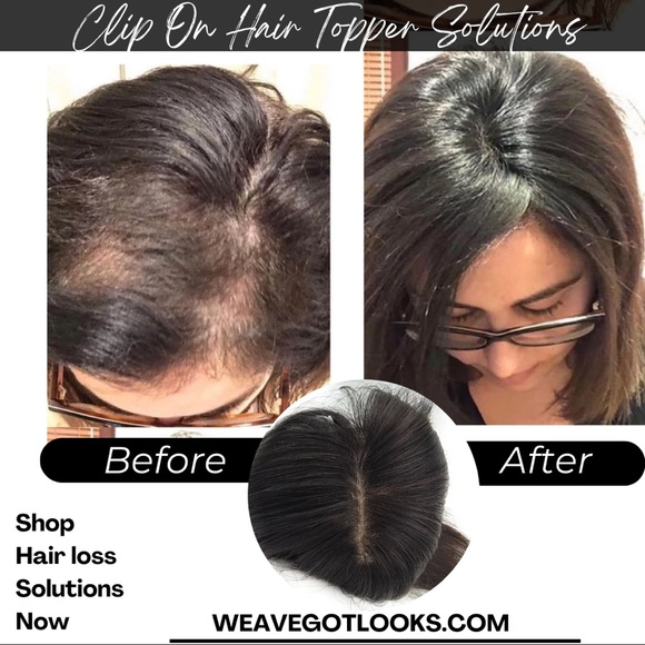 Crown Hair Toppers for Thinning Hair- Natural Black - Length: 10” Size: 3x5 in. - Picture 3 of 6